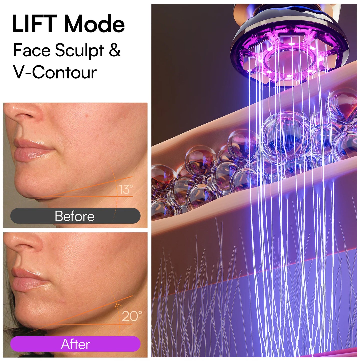 Microcurrent Facial Device