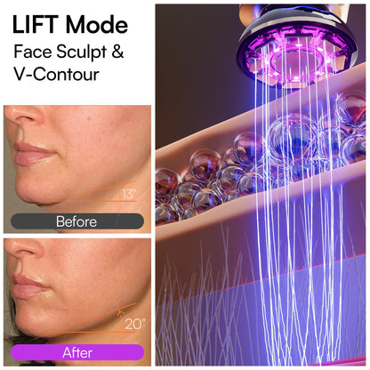 Microcurrent Facial Device