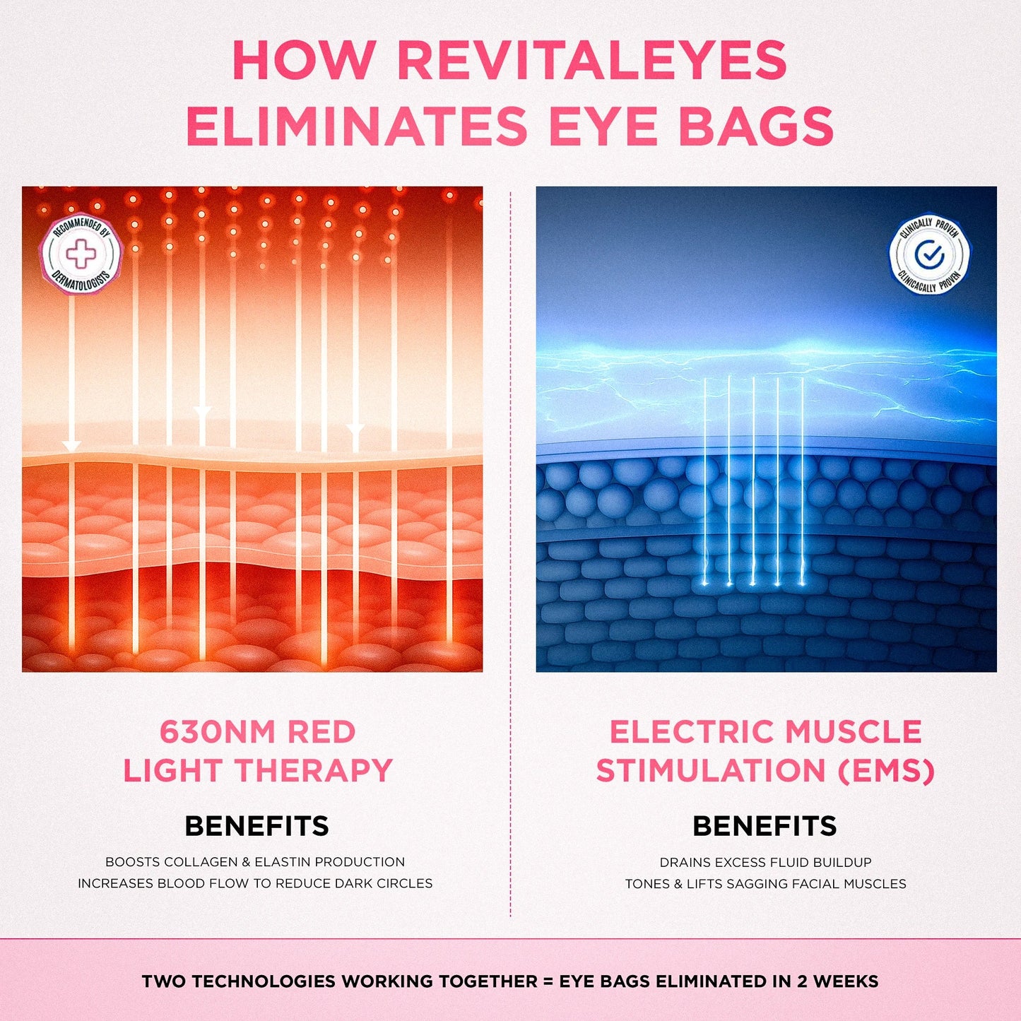 EyeLift Pro® 2-in-1 Red Light Therapy + EMS To Erase Eye Bags