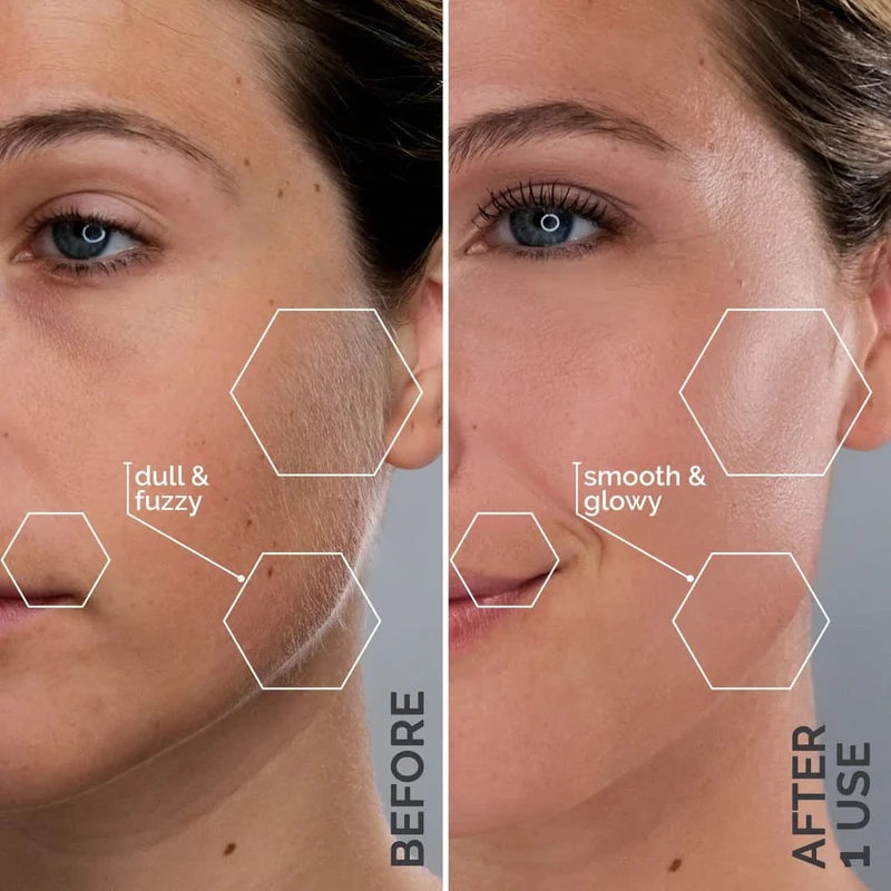 GlowSonic | The 5-Minute Secret To Smooth, Glowing Skin
