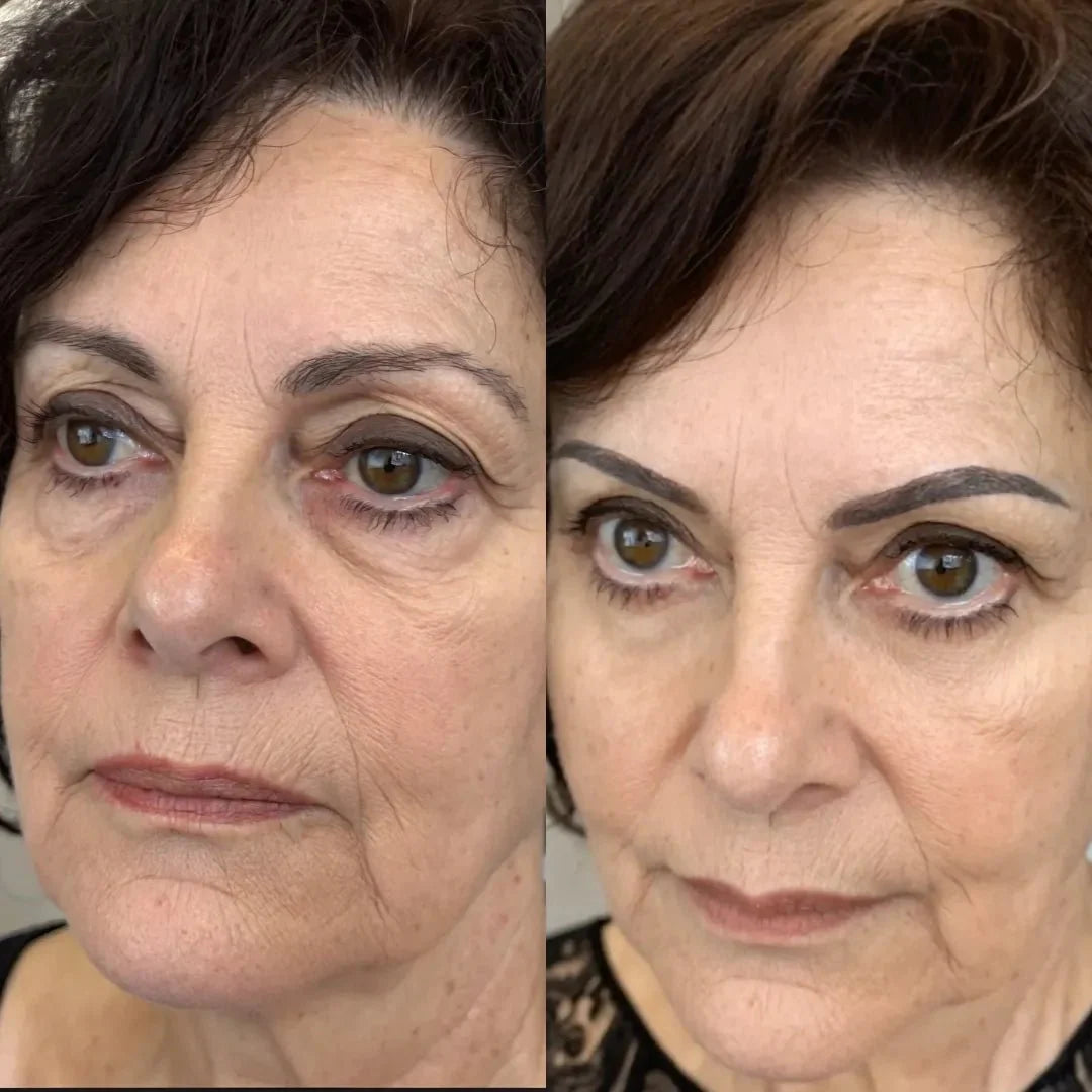 EyeLift Pro® 2-in-1 Red Light Therapy + EMS To Erase Eye Bags