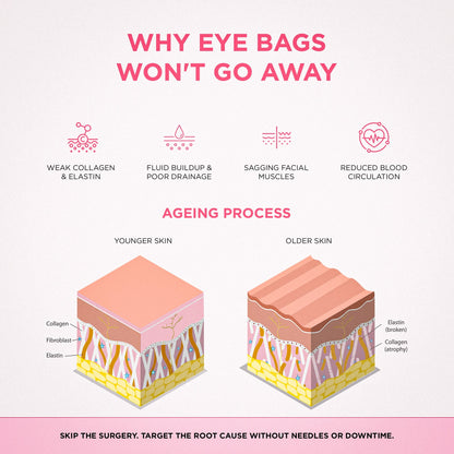 EyeLift Pro® 2-in-1 Red Light Therapy + EMS To Erase Eye Bags